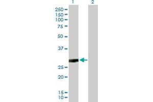 Western Blot analysis of CACNG3 expression in transfected 293T cell line by CACNG3 MaxPab polyclonal antibody.