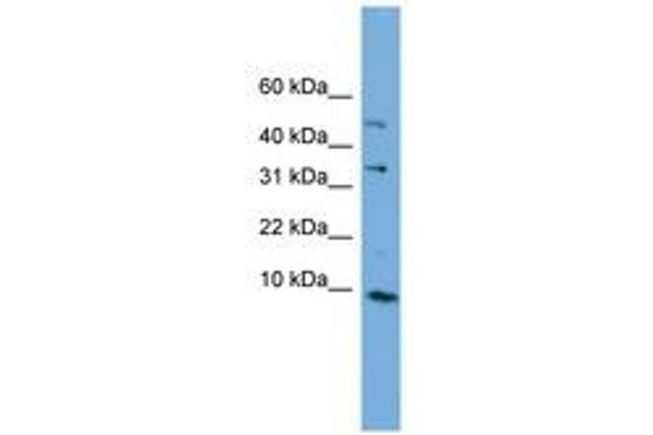 C16orf61 antibody  (C-Term)
