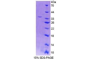 Image no. 1 for Carboxylesterase 1 (CES1) (AA 19-300) protein (His tag) (ABIN6236864)