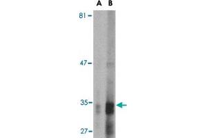 Image no. 1 for anti-Endonuclease G (ENDOG) antibody (ABIN534458)