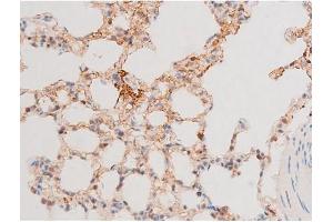 Image no. 5 for anti-GATA Binding Protein 4 (GATA4) (pSer262) antibody (ABIN6256227)