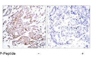Image no. 1 for anti-Myc Proto-Oncogene protein (MYC) (pThr58) antibody (ABIN196672)