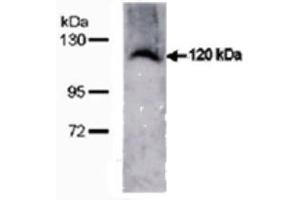 Image no. 4 for anti-Transmembrane Protein 67 (TMEM67) (C-Term) antibody (ABIN347657)