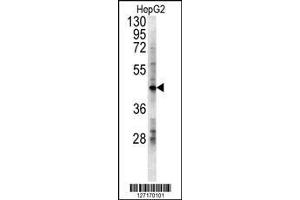 Image no. 1 for anti-Lactate Dehydrogenase D (LDHD) (N-Term) antibody (ABIN2489184)