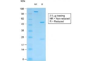 Image no. 1 for anti-S100 Calcium Binding Protein B (S100B) antibody (ABIN6940559)