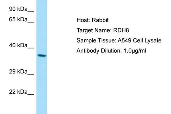 RDH8 抗体  (Middle Region)