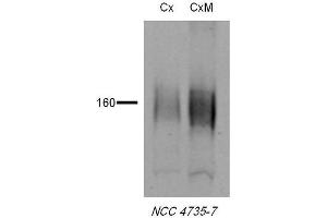 Image no. 2 for anti-Solute Carrier Family 12 (Sodium/Chloride Transporters), Member 3 (SLC12A3) (AA 74-95) antibody (PE) (ABIN2486297)