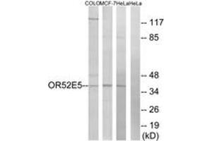 OR52E5 anticorps  (AA 199-248)
