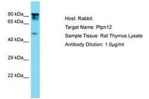 Image no. 1 for anti-Protein Tyrosine Phosphatase G1 (PTPN12) (AA 591-640) antibody (ABIN6750360)