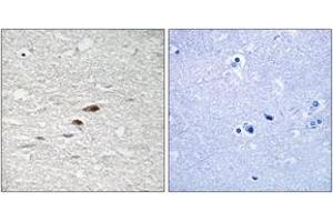 Image no. 2 for anti-Adenomatous Polyposis Coli (APC) (AA 2020-2069), (pSer2054) antibody (ABIN1531521)