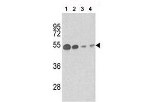 Image no. 1 for anti-Tubulin, beta 1 (TUBB1) antibody (ABIN3029794)