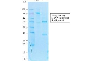 Image no. 4 for anti-Keratin 7 (KRT7) antibody (ABIN6939879)