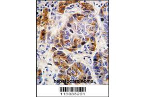 Image no. 1 for anti-Aldehyde Dehydrogenase 4 Family, Member A1 (ALDH4A1) (AA 288-314) antibody (ABIN392357)