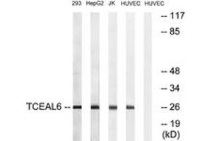Image no. 1 for anti-Transcription Elongation Factor A (SII)-Like 6 (TCEAL6) (AA 61-110) antibody (ABIN1535418)