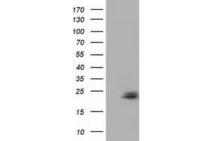anti-Ephrin A2 (EFNA2) antibody
