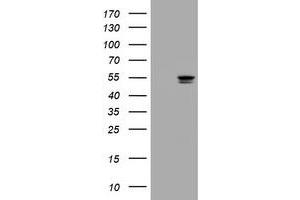 Image no. 2 for anti-Thymidine Phosphorylase (TYMP) (AA 311-482) antibody (ABIN1491396)