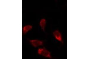 Image no. 3 for anti-Uracil-DNA Glycosylase (UNG) (Internal Region) antibody (ABIN6265896)