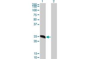 anti-DPY30 Domain Containing 2 (DYDC2) (AA 1-177) antibody
