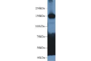 Image no. 1 for anti-Ca++-Dependent Secretion Activator (CADPS) (AA 1186-1352) antibody (ABIN5013276)
