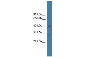 Image no. 1 for anti-serpin Peptidase Inhibitor, Clade B (Ovalbumin), Member 7 (SERPINB7) (N-Term) antibody (ABIN929173)