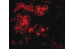 Image no. 2 for anti-Lymphocyte Antigen 96 (LY96) (Internal Region) antibody (ABIN6656263)