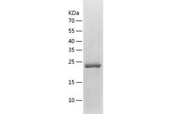 PDCD10 Protein (AA 1-212) (His tag)