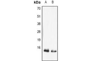 Image no. 2 for anti-Fatty Acid Binding Protein 5 (Psoriasis-Associated) (FABP5) (full length) antibody (ABIN6043434)