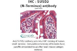 Image no. 2 for anti-Sushi Domain Containing 2 (SUSD2) (N-Term) antibody (ABIN1739807)