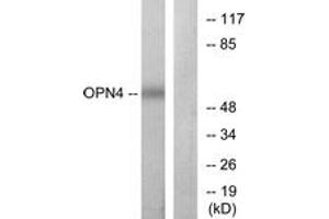 Image no. 1 for anti-Opsin 4 (OPN4) (AA 429-478) antibody (ABIN1535846)