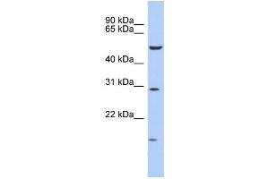 Image no. 1 for anti-Homeobox C5 (HOXC5) (Middle Region) antibody (ABIN2777271)