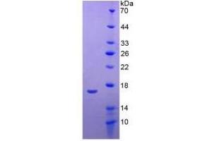 Image no. 5 for Apolipoprotein A-I (APOA1) ELISA Kit (ABIN6574163)