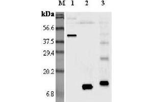 Image no. 1 for anti-Resistin (RETN) antibody (ABIN1169369)