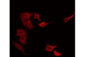 Image no. 3 for anti-HCG beta antibody (ABIN6262161)