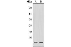 Image no. 1 for anti-Eukaryotic Translation Initiation Factor 1 (EIF1) (C-Term) antibody (ABIN2704754)