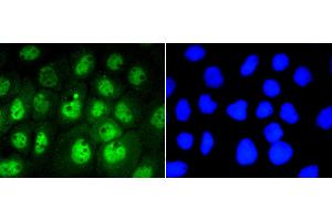 Image no. 4 for anti-Signal Transducer and Activator of Transcription 3 (Acute-Phase Response Factor) (STAT3) (pSer727) antibody (ABIN5557530)