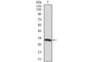 Image no. 5 for anti-Twinfilin, Actin-Binding Protein 1 (TWF1) (AA 335-384) antibody (ABIN1098116)