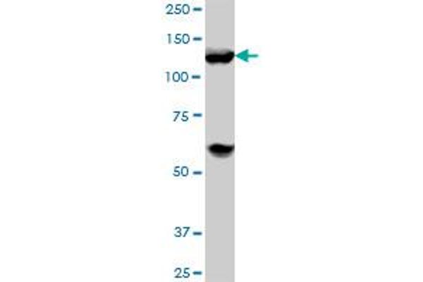 anti-Histone Deacetylase 4 (HDAC4) (AA 551-648) antibody