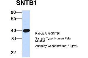Image no. 3 for anti-Syntrophin, beta 1 (Dystrophin-Associated Protein A1, 59kDa, Basic Component 1) (SNTB1) (N-Term) antibody (ABIN2781530)
