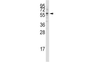 Image no. 3 for anti-K(lysine) Acetyltransferase 5 (KAT5) (AA 33-64) antibody (ABIN3031520)