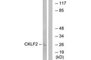 Image no. 1 for anti-CKLF-Like MARVEL Transmembrane Domain Containing 2 (CMTM2) (AA 171-220) antibody (ABIN2890220)