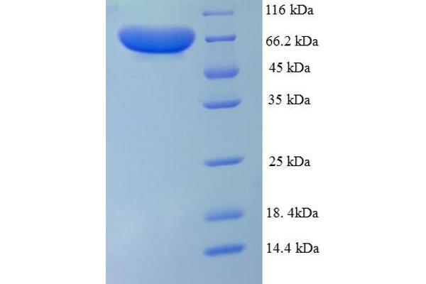 PADI1 Protein (AA 1-663, full length) (His tag)