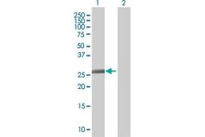 Image no. 1 for anti-Zinc Finger, C3HC-Type Containing 1 (ZC3HC1) (AA 1-212) antibody (ABIN526782)