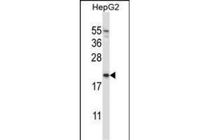 NDUFAF2 antibody  (AA 71-99)