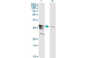 Image no. 5 for anti-GTP Cyclohydrolase 1 (GCH1) (AA 84-172) antibody (ABIN561018)