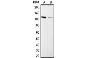 Image no. 3 for anti-Collagen, Type VI, alpha 2 (COL6A2) (Center) antibody (ABIN2705914)