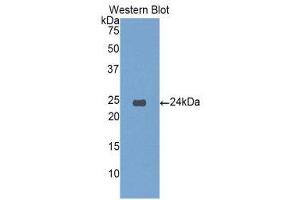 Image no. 1 for anti-Insulin-Like Growth Factor Binding Protein 6 (IGFBP6) (AA 51-226) antibody (ABIN1859311)
