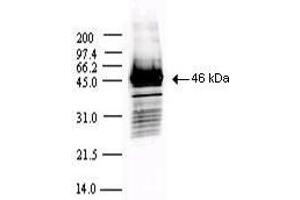 Image no. 5 for anti-SARS-Coronavirus Nucleocapsid Protein (SARS-CoV N) antibody (ABIN6952544)