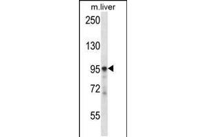 Image no. 1 for anti-Phospholipase C delta 3 (PLCd3) (AA 60-89), (N-Term) antibody (ABIN5533293)