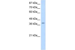 Image no. 1 for anti-K(lysine) Acetyltransferase 6B (KAT6B) antibody (ABIN2461835)