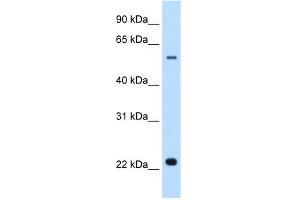 Image no. 3 for anti-Solute Carrier Family 17 (Acidic Sugar Transporter), Member 5 (SLC17A5) (N-Term) antibody (ABIN2781631)